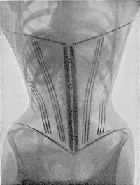 Corset damage to internal organs