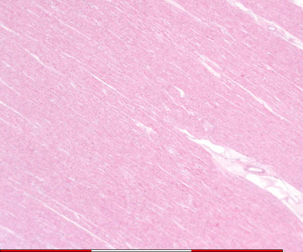 heart muscle
