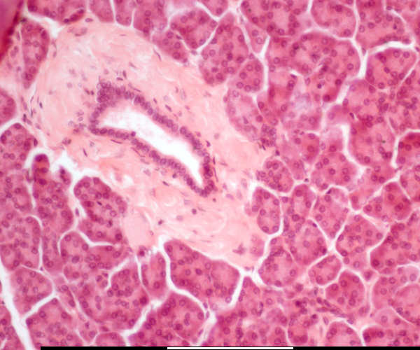 Centroacinar Cell