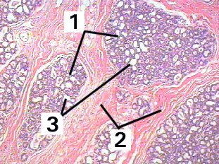 Fig 57-003