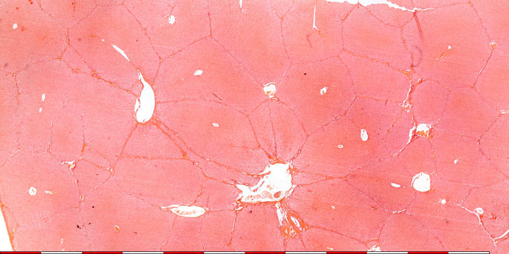 liver