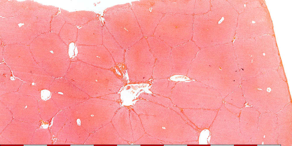 liver