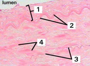 Fig 69-002