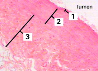 Fig 69-004