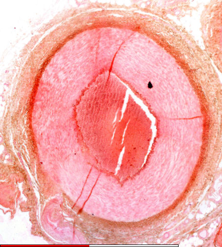 Muscular artery