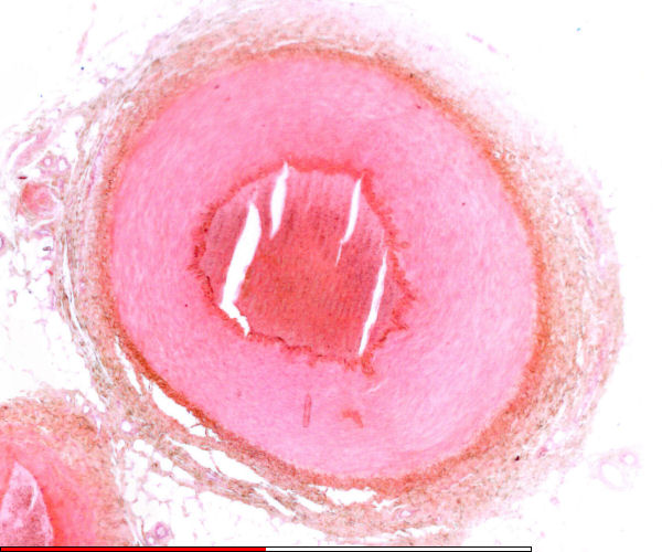 Muscular artery