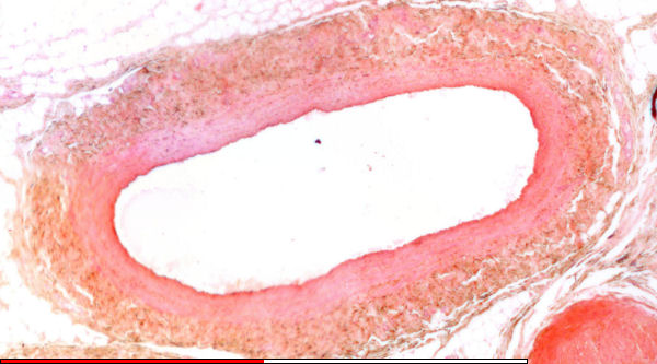 Muscular artery