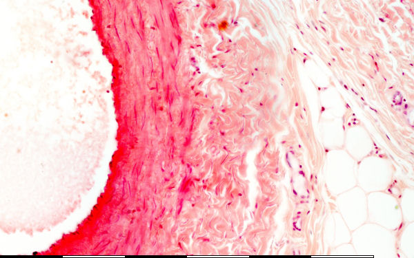 medium vein