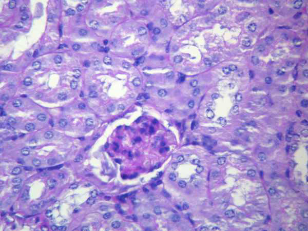 PAS stain of the glomerulus