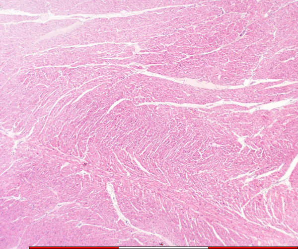 heart muscle