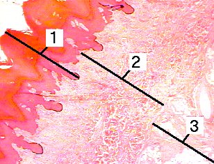 Fig 93-002