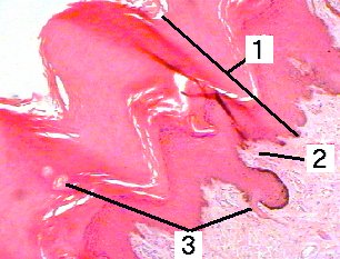Fig 93-003