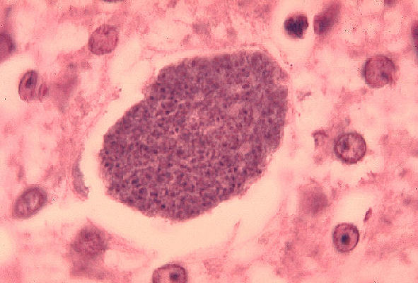 Malaria in the liver