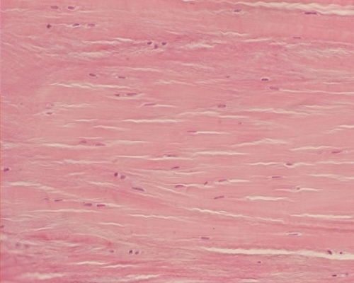 Fibrocartilage