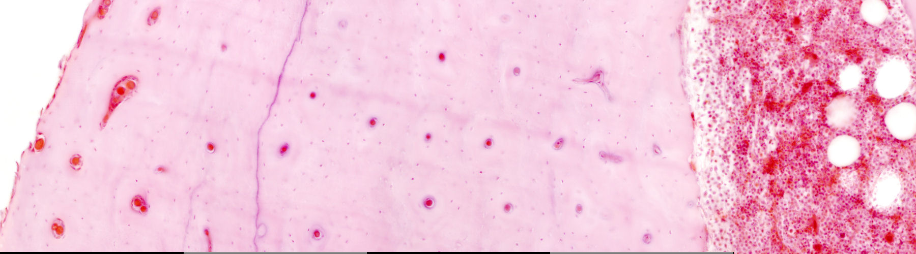 Cross section of decalcified bone