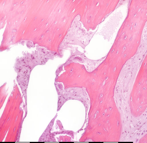 Medium magnification of immature bone