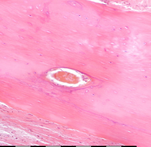 Medium magnification of immature bone