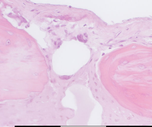 Osteoclast progenitor cells