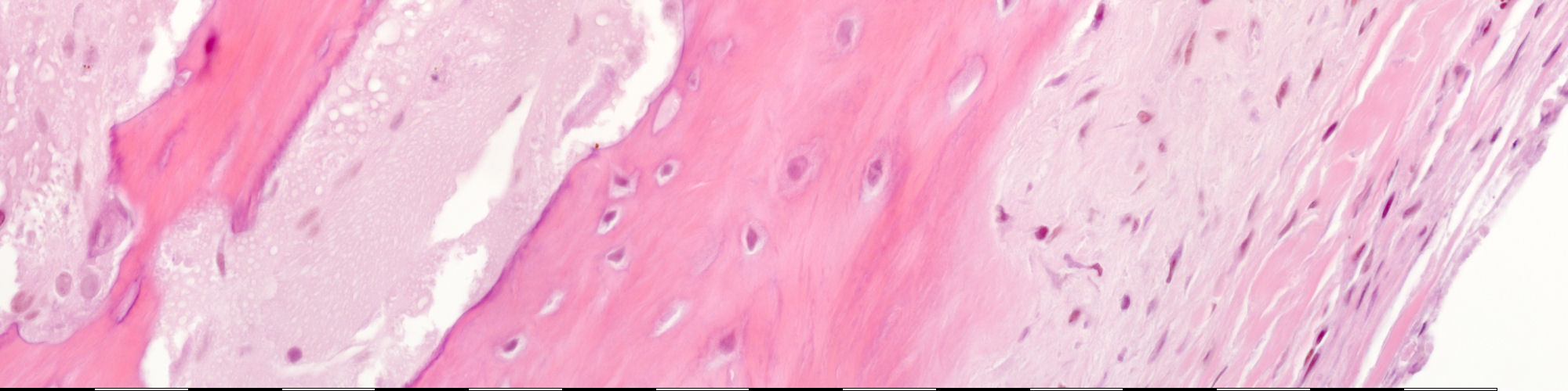 Medium magnification of immature bone from the vault