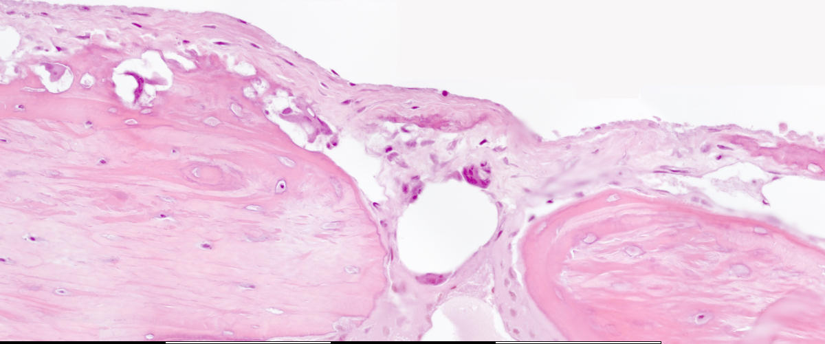 osteoprogenitor cells