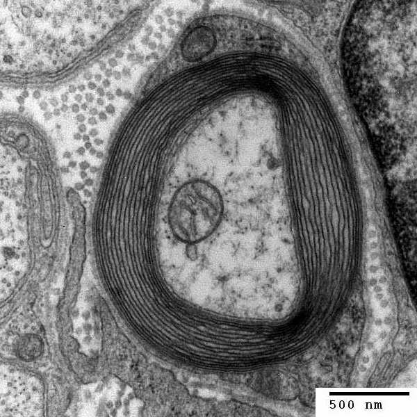 myelinated axon