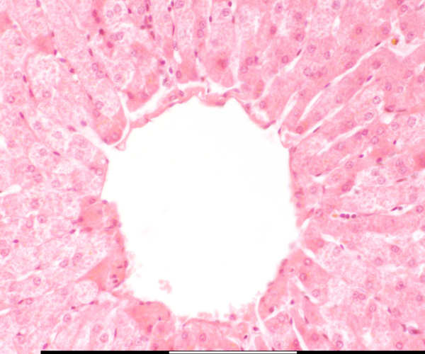 High magnification of the liver