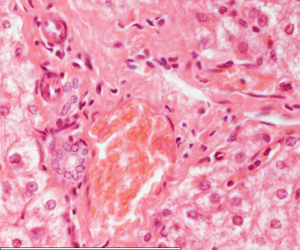 High magnification of the liver