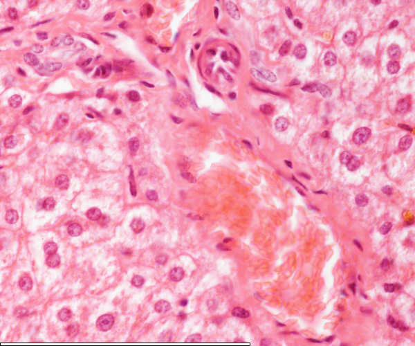 High magnification of the liver