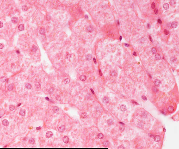 High magnification of the liver