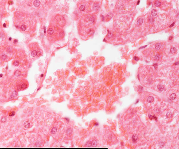 High magnification of the liver