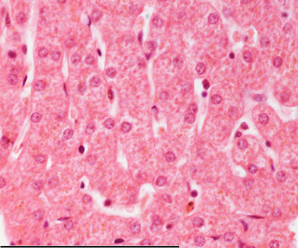 High magnification of the liver