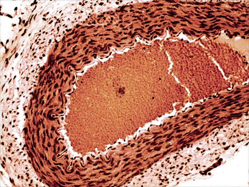 Rabbit arteriole