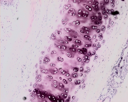 Hyaline cartilage