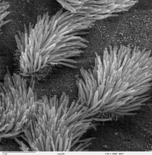 Lung trachea epithelium