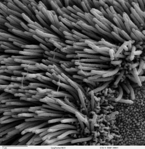 Lung trachea epithelium