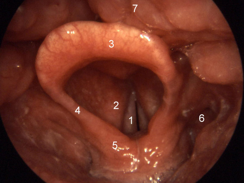 normal larynx