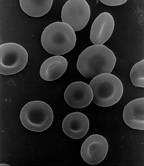 Normal red blood cells