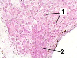 Fig Coch-004