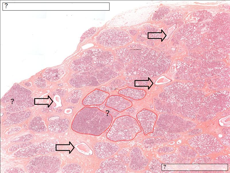 Mammary gland and Nipple