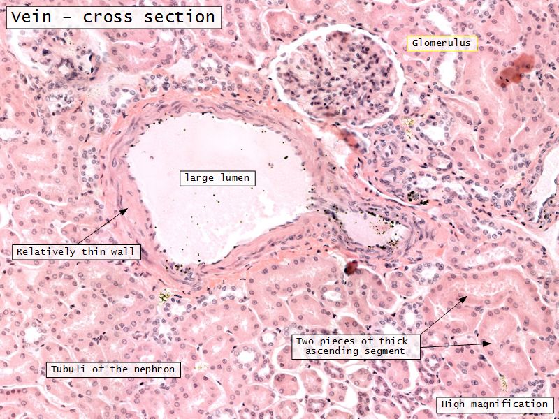 Slides 28 and 76: Kidney