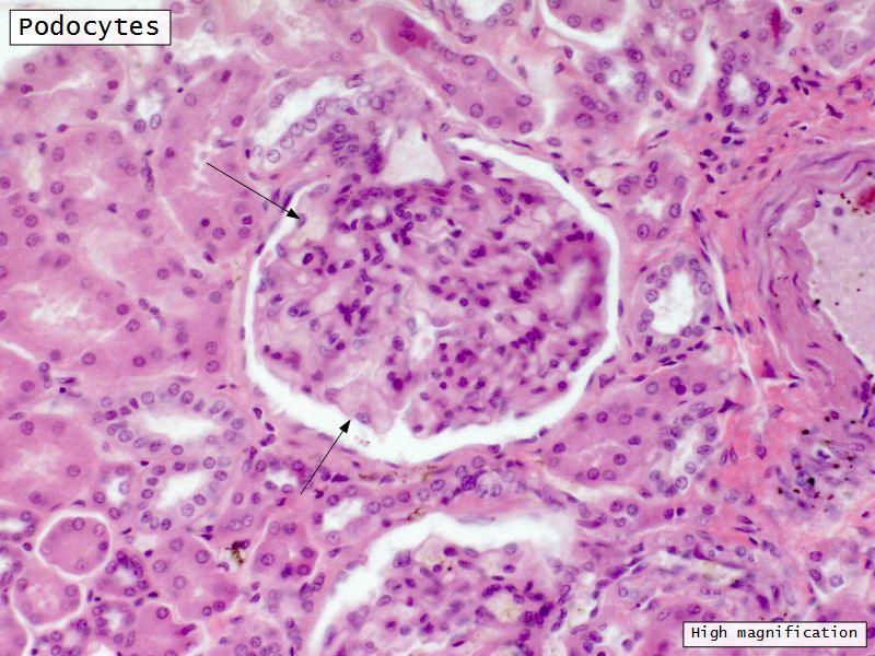 Slides 28 and 76: Kidney