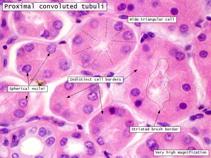 Slides 28 and 76: Kidney