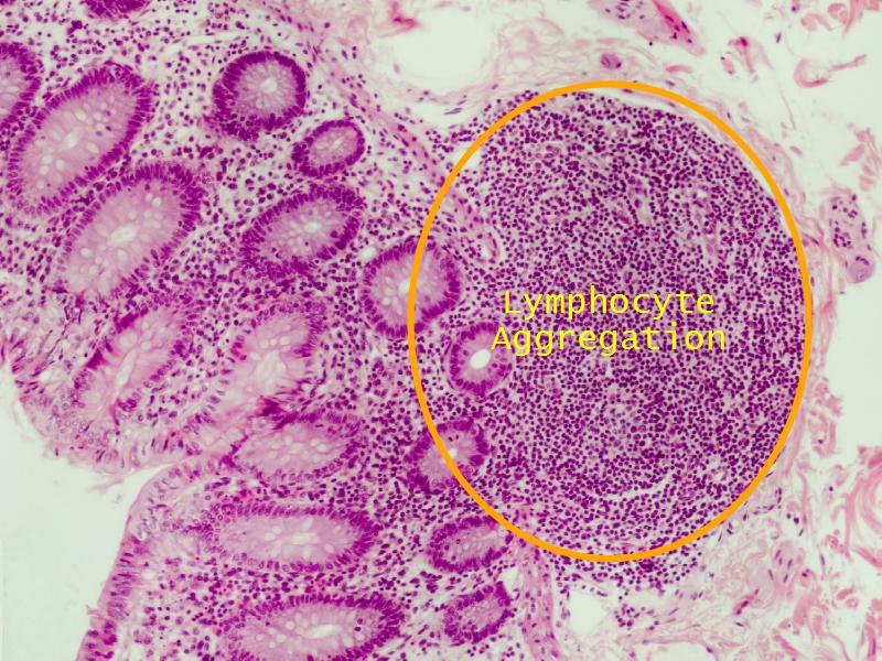 Glandular Epithelium