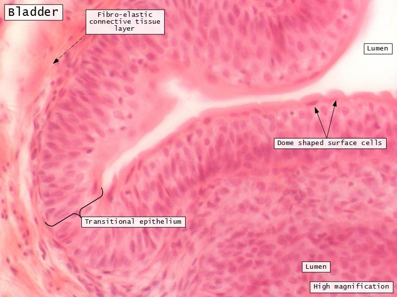 Slides 78 and 79: Ureter and Bladder