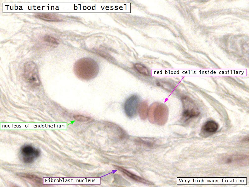 Uterine tube