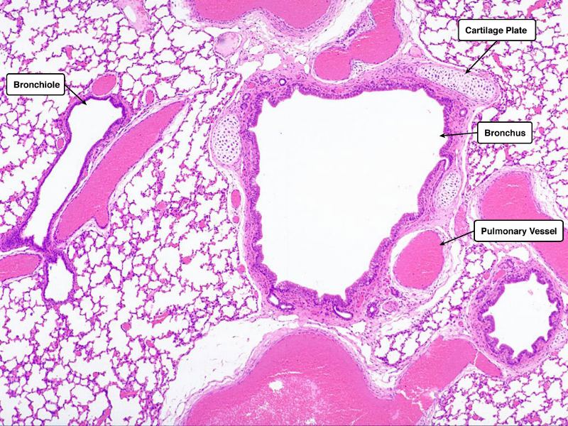 Overview: Liver, Lung, Lymphoid, Kidney and Skin