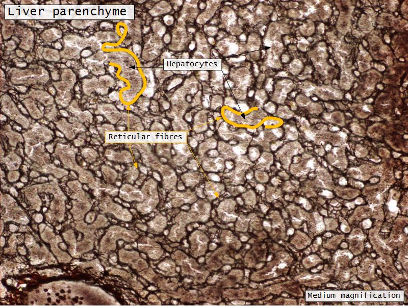 Liver Reticular Liver